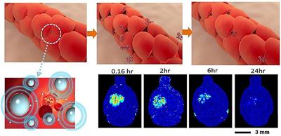 Theranostic Strategy of Focused Ultrasound Induced Blood-Brain Barrier Opening for CNS Disease Treatment